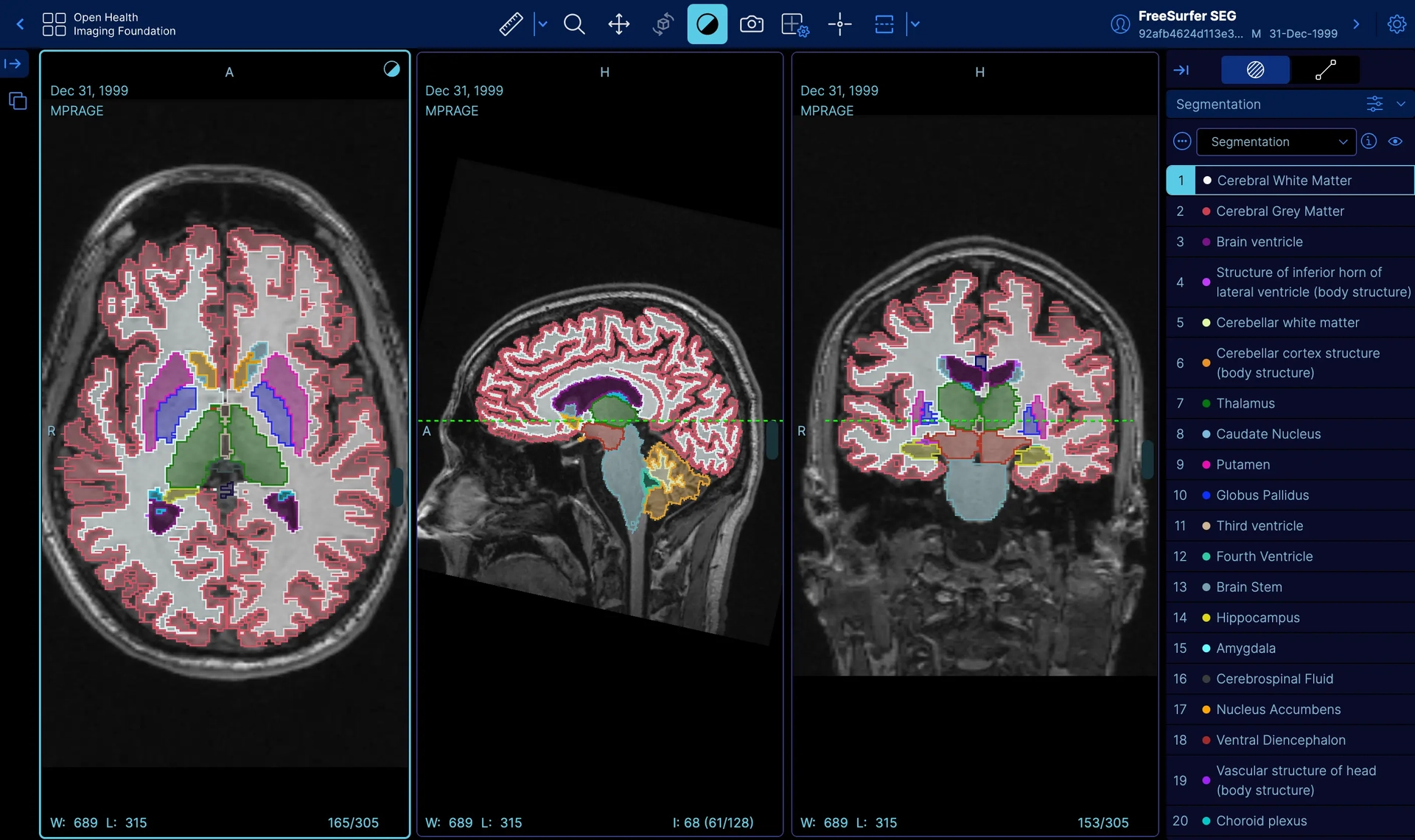 DBD PACS Segmentation Viewer